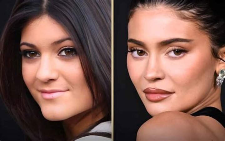 Kylie Jenner Addresses Her Lip Fillers & Face Surgery Speculation – Hollywood Life